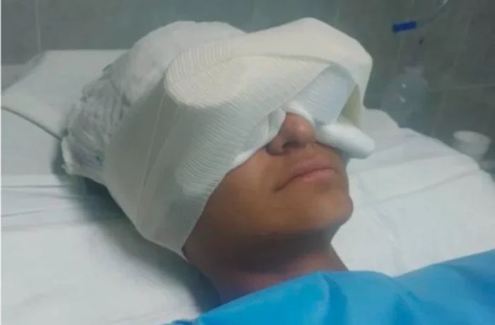 Un joven perdió el ojo izquierdo en un experimento no supervisado.